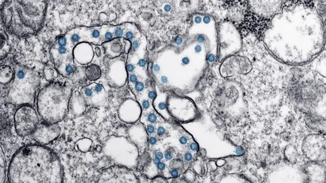 Combater o Surto de Ebola na República Democrática do Congo: Desafios e Perspect