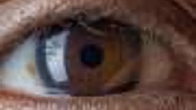 Informação Genética Ajuda a Prever o Início e a Progressão da Glaucoma