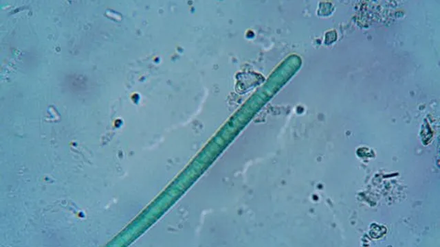 Hookworms Engineirados: Uma Nova Abordagem em Farmacêutica