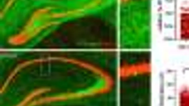 Proteína SORLA: descoberta importante na luta contra a doença de Alzheimer